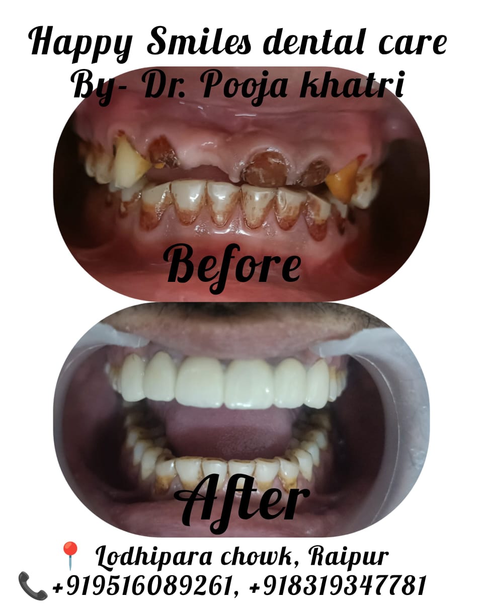 After Treatment